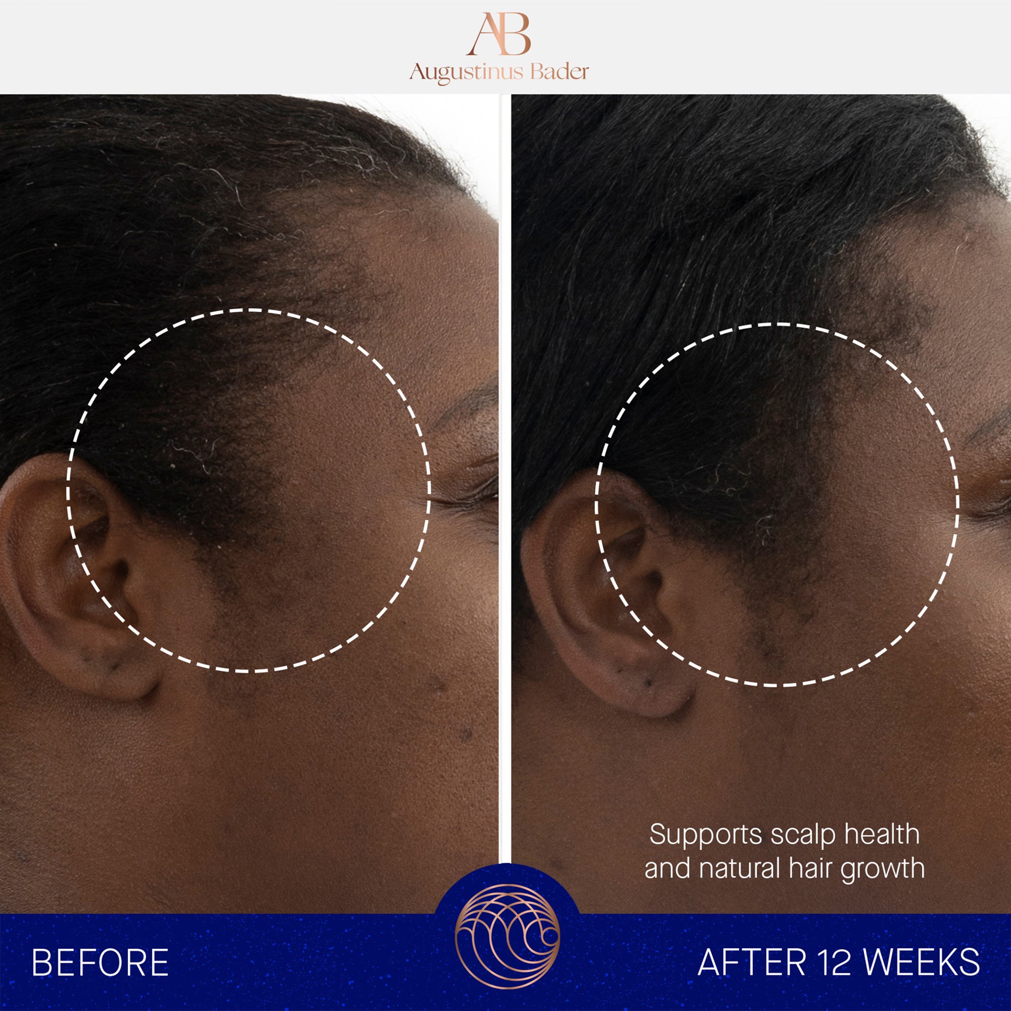 Augustinus Bader The Scalp Treatment (1 oz)