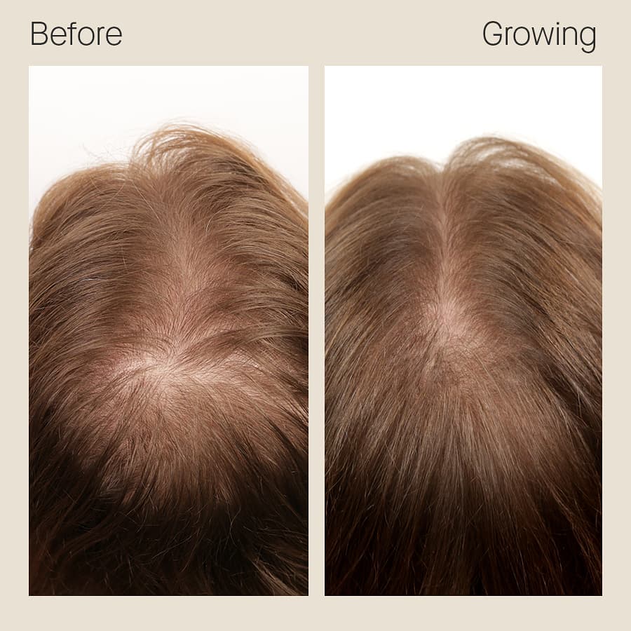 Nutrafol Women's Hair Growth Nutraceutical (120 Capsules)