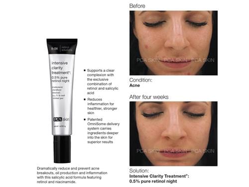 PCA Skin Intensive Clarity Treatment (1 oz)